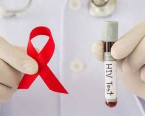 Usia Produktif Dominasi Kasus AIDS di Riau, Laki-laki Paling Banyak Terdampak